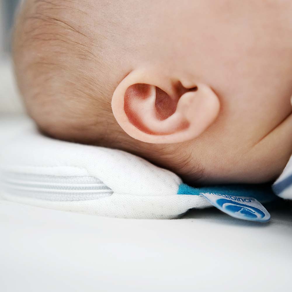 Medibino Babykopfschutz - schützt vor Kopfverformungen in Rückenlage
